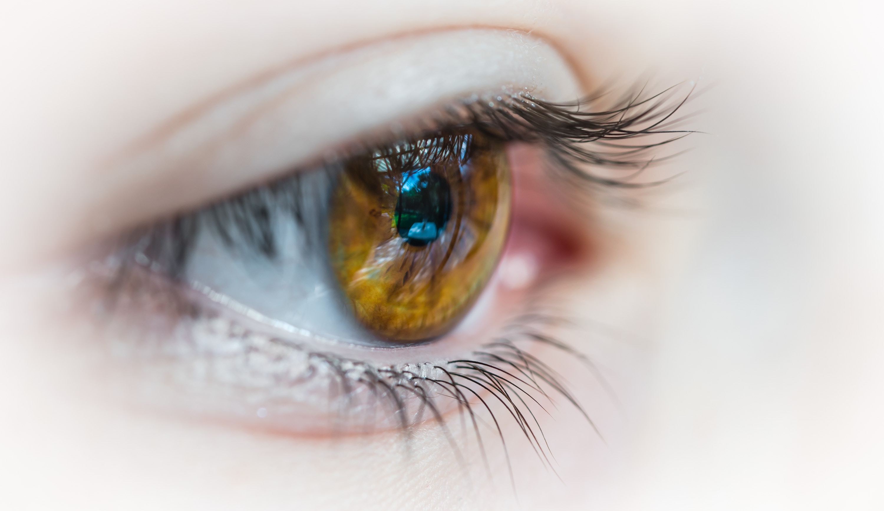 sintomas de glaucoma